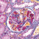 brightfield_renal-tissue_Axio-Imager